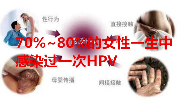 70%~80%的代妈一生中感染过一次HPV